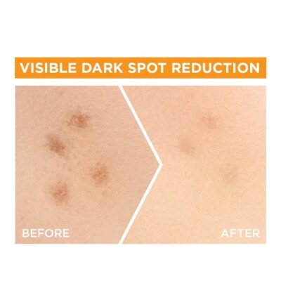 Garnier Skin Naturals, Bright Complete 30X Vitamin C Booster Face Serum, Increases Skin's Glow Instantly and Reduces Spots Overtime, with 2% Niacinamide + 0.5% Salicylic Acid, for Men & Women, 30 ml - Image 5
