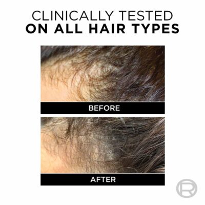 L'Oréal Paris Anti-Hair Fall Conditioner, Reinforcing & Nourishing for Hair Growth, For Thinning & Hair Loss, With Arginine Essence and Salicylic Acid, Fall Resist 3X, 180/192.5 ML (Weight May Vary) - Image 3