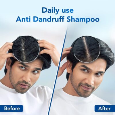 Scalpe Pro Daily Anti-Dandruff Shampoo | Removes Dandruff From Source | Helps With Itching, Irritation & Redness Accompanying Dandruff | Climbazole & Zpto Formulation | For Women & Men | 100Ml - Image 2