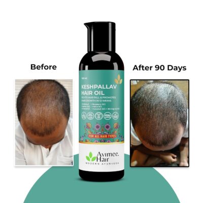 Avimee Herbal Keshpallav Hair Oil For Men & Women | Promotes Hair Growth & Reduces Hair Fall | With Rosemary, Castor, Amla, Coconut and Bhringraj Oil | Mineral Oil Free | 100 ml - Image 3
